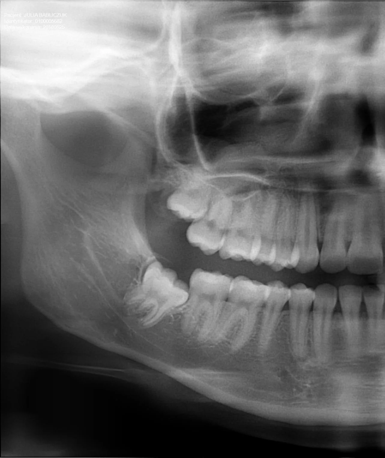 Przed zabiegiem chirurgicznym - MEDENT Bolesławiec