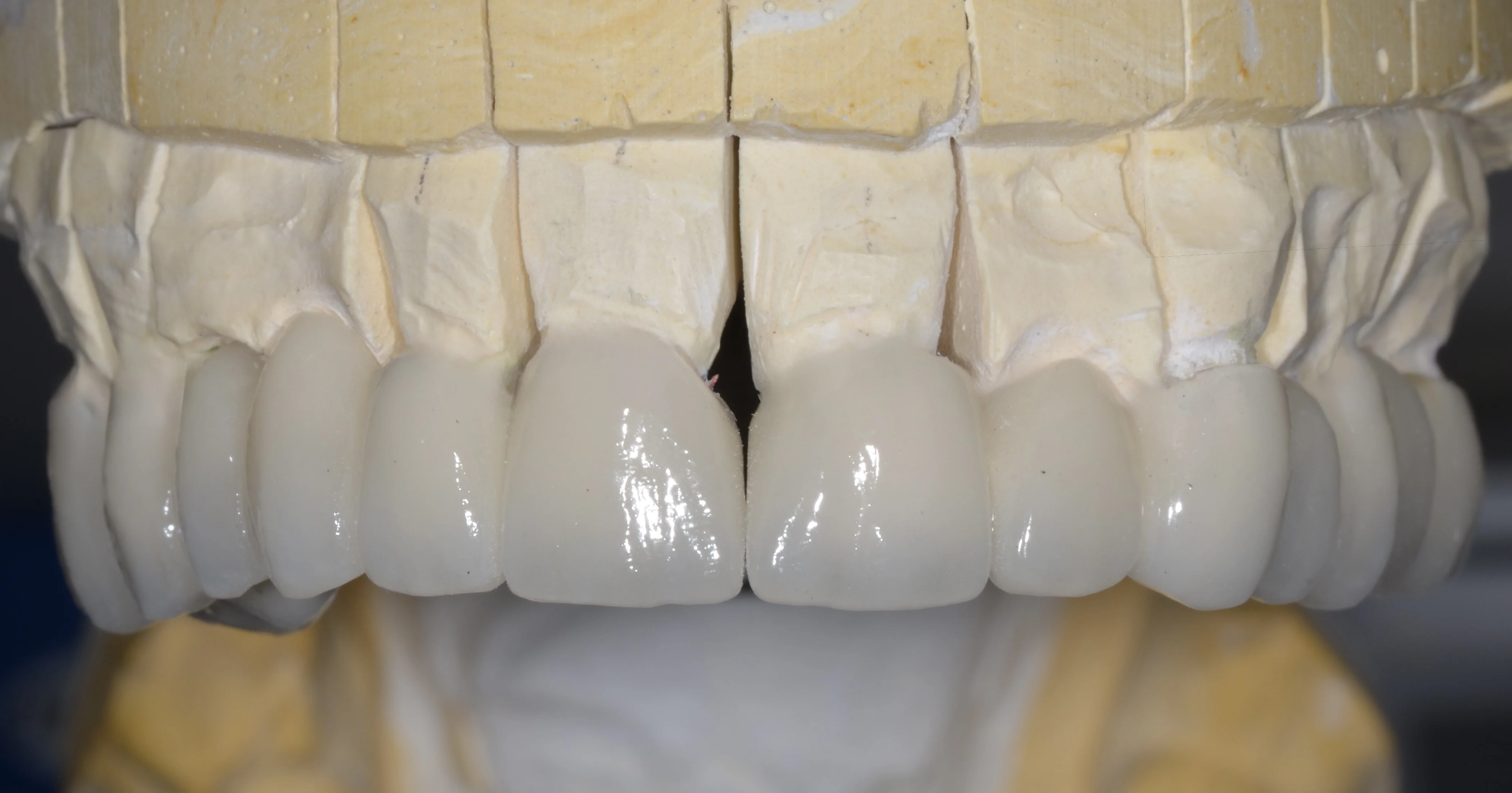 Protetyka w&nbsp;MEDENT